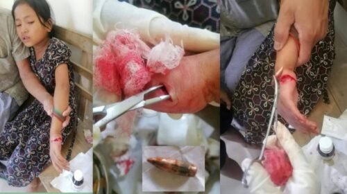 সাজেকে ইউপিডিএফ ও জেএসএস সংঘর্ষ, গুলিবিদ্ধ ৮ বছরের শিশু, আতঙ্কে এলাকাবাসী